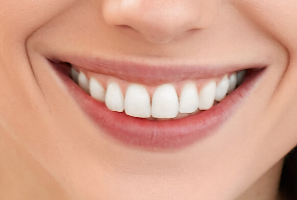 teeth photoshop actions